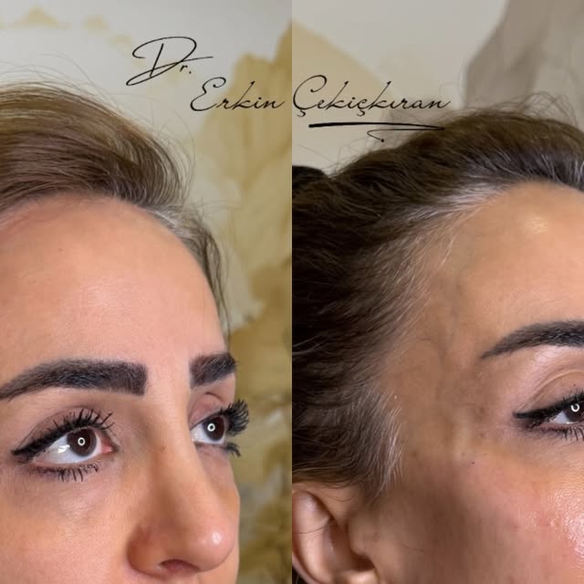 Full Face Transformation